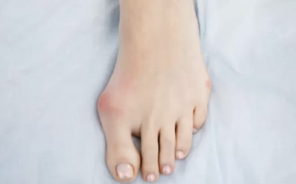 【必見!】外反母趾の痛みは姿勢が原因だった!女性のための根本改善の秘密とは…!